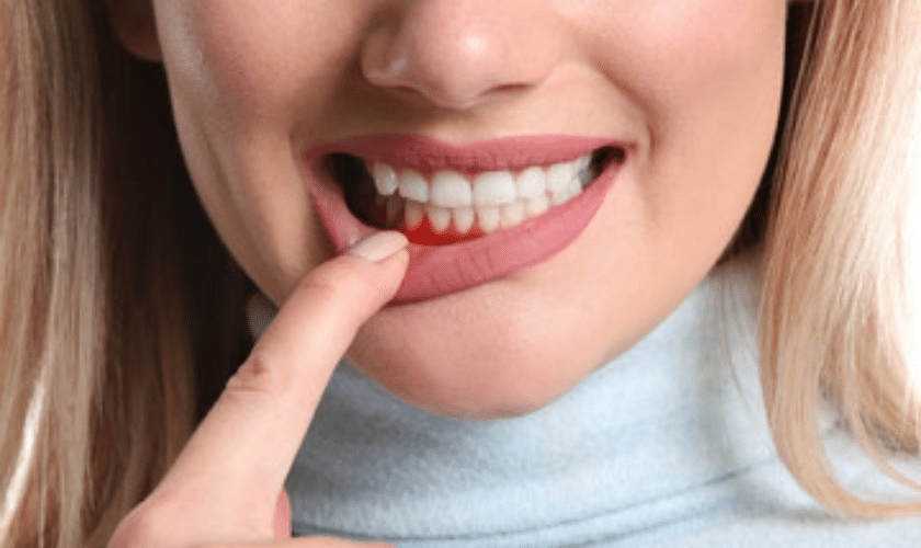 causes of periodontal disease