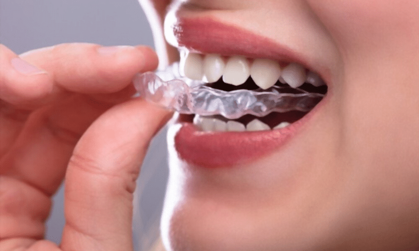 Clear Correct Dental