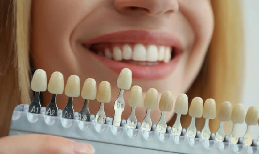Ultimate Guide To Teeth Whitening: Tips And Tricks For A Brighter Christmas