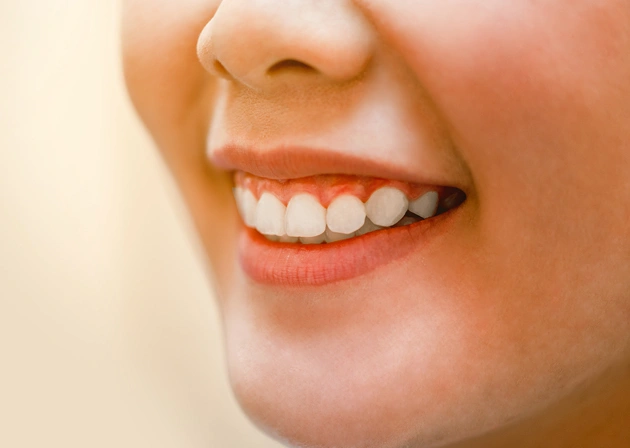 Close-up of smiling woman displaying bright, white teeth and healthy smile.