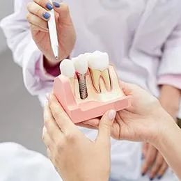 Dentist demonstrating dental implant model to patient in clinical setting.