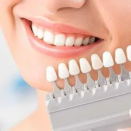 Woman smiling displaying dental shade guide for tooth color matching and whitening comparison.