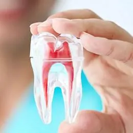 Dental model showing tooth cross-section with red pulp and blue root canal anatomy.