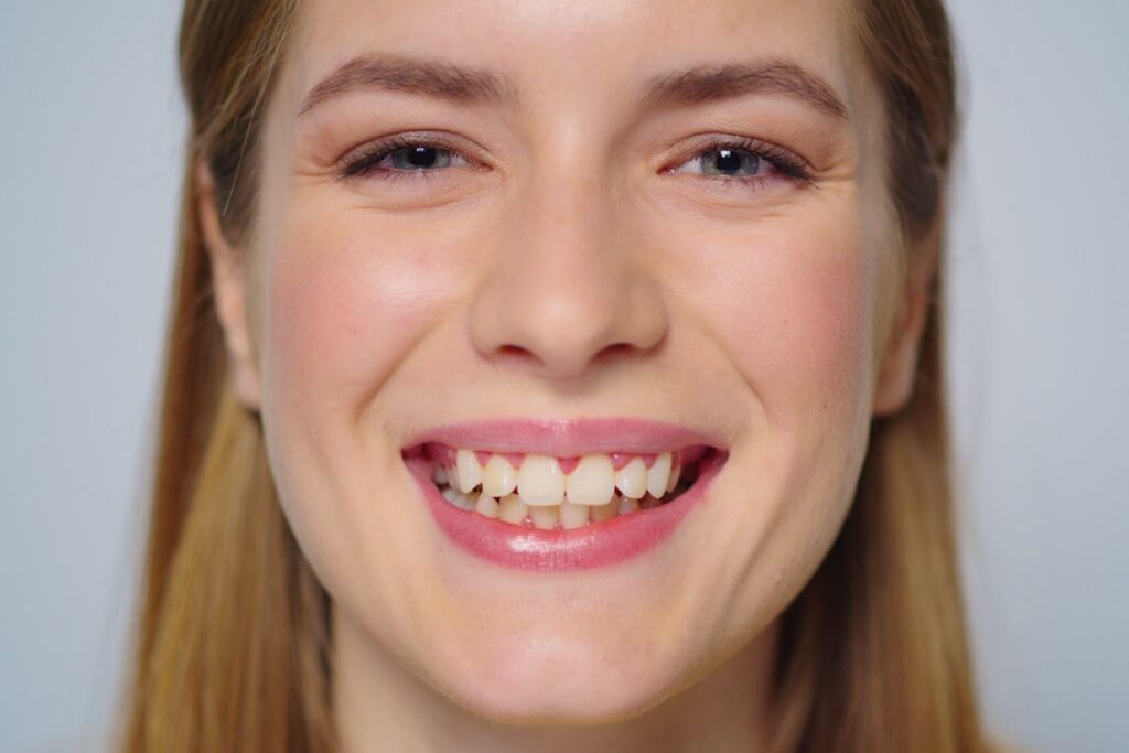 A close-up smile highlights small gaps between the teeth, showing a common cosmetic dental concern that can be improved with treatment.
